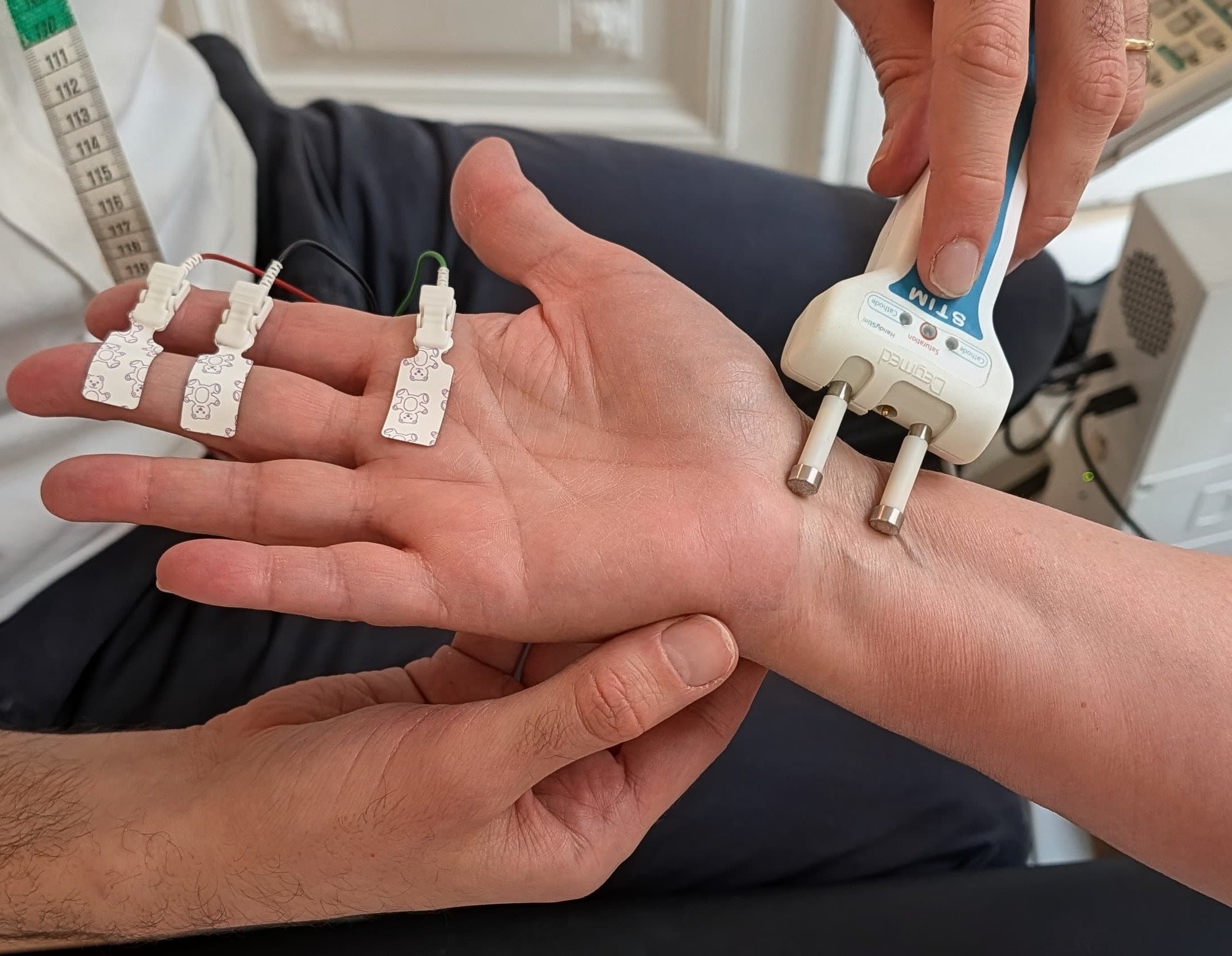 Test de conduction nerveuse sur une main avec un stimulateur électronique et des électrodes.